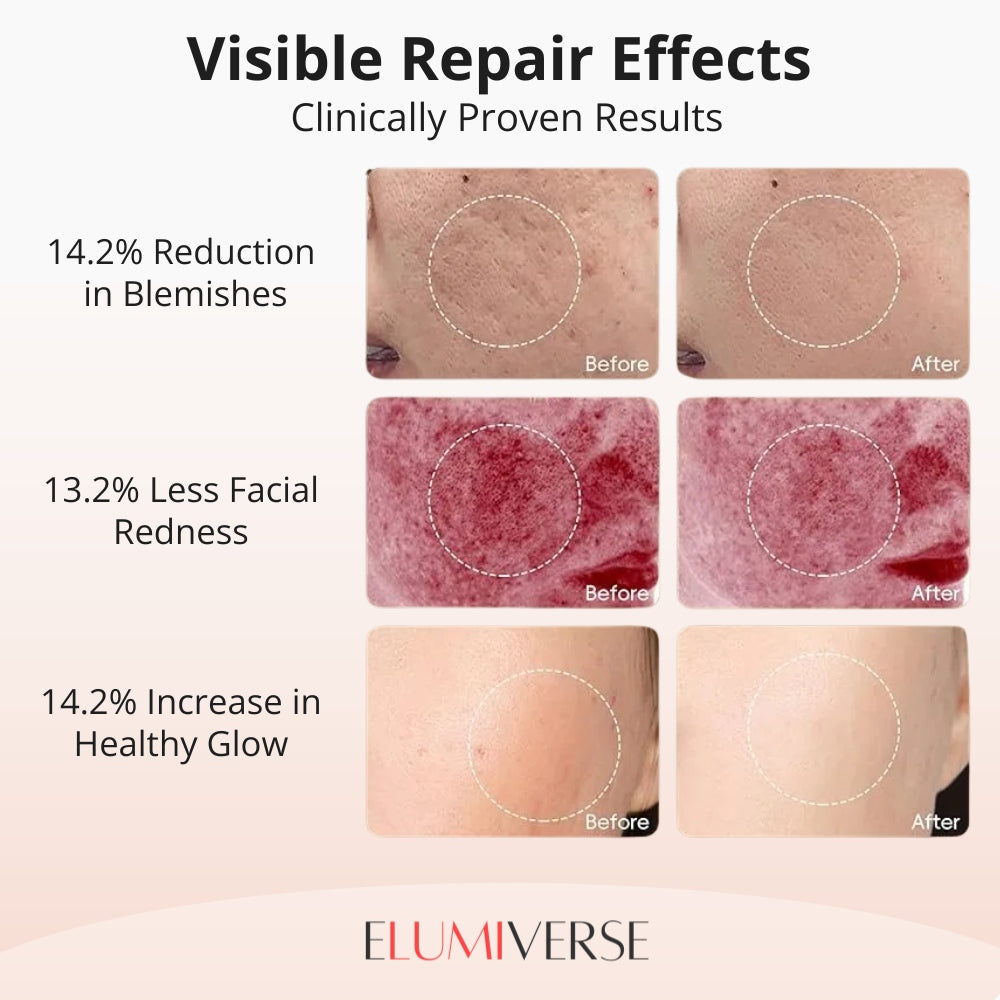 Elumi Light Therapy Mask