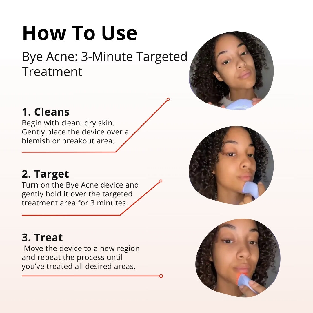 Elumi Acne Wand