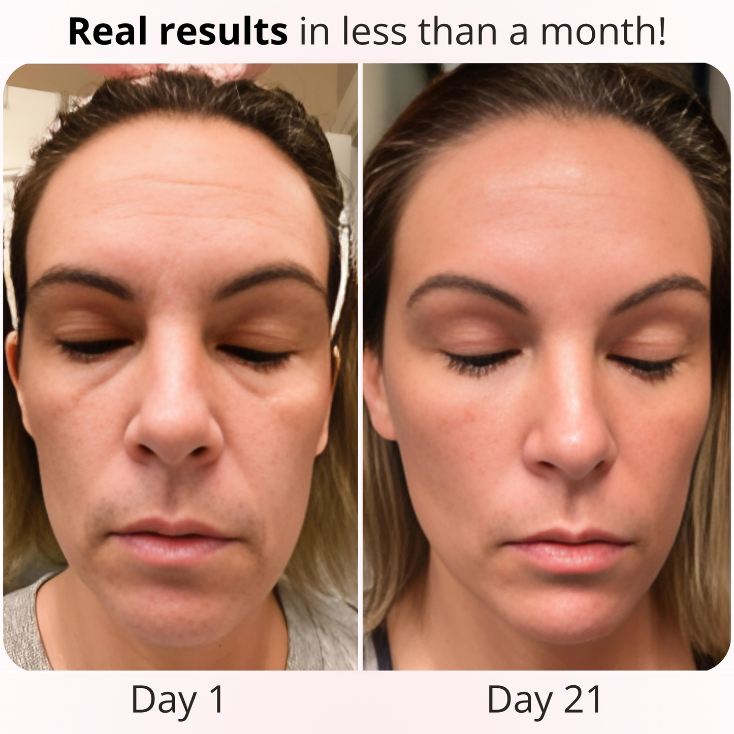 4-in-1 Skincare Wand