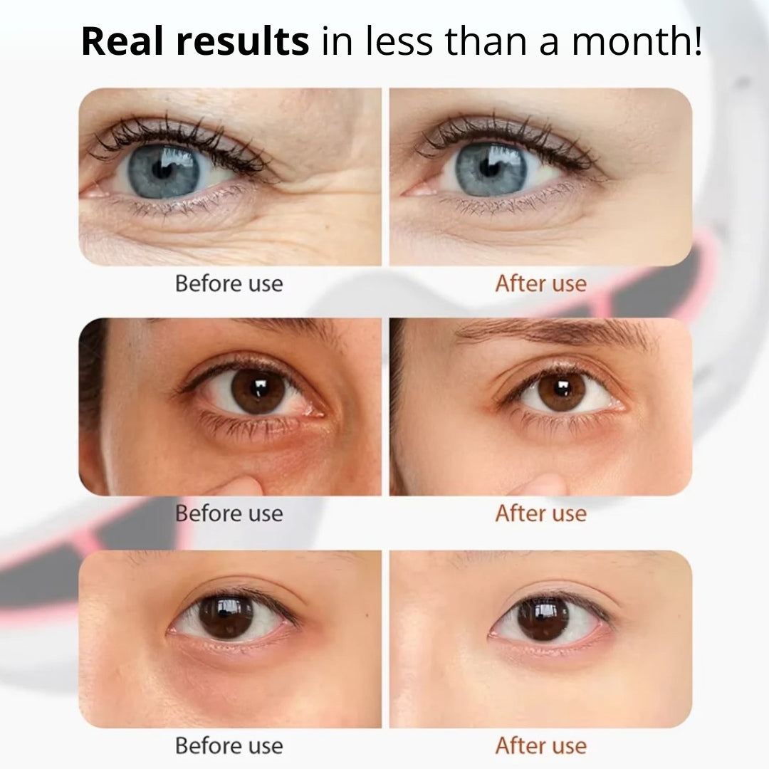 ElumiVerse Red Light Eye Massager